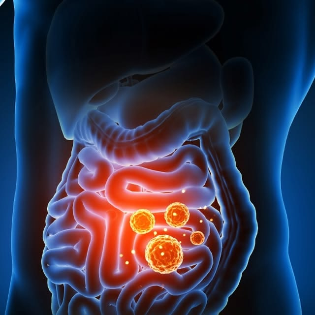 image Why Do I Feel Tired After Eating